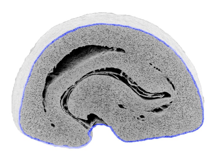 bean outer extraction