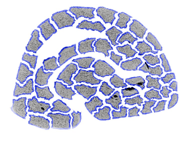 coffee bean particles (1)